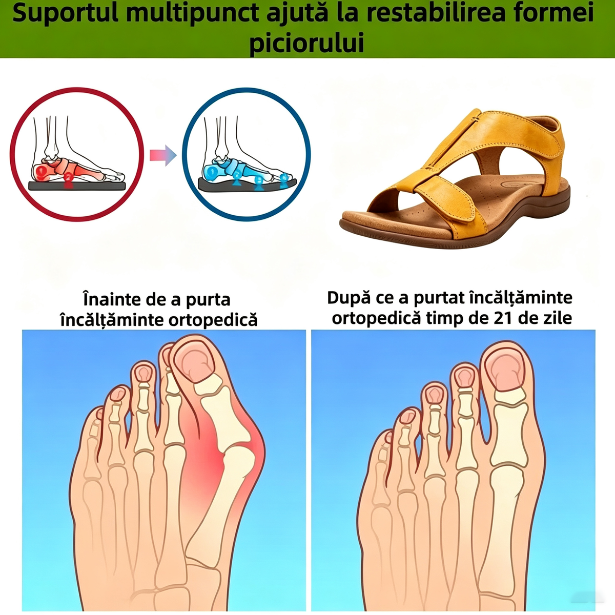 🎁Ultima zi la jumătate de preț, nu ratați|Sandale ortopedice cu design ergonomic și suport pentru bolta plantară✅️ pentru mers fără durere👞
