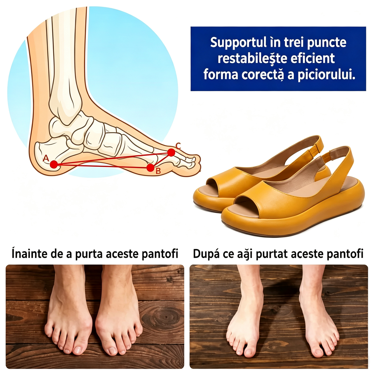 ⏰Ultima zi cu reducere de 50% - Nu rata ocazia!✅️Sandale confortabile cu suport pentru bolta plantară - Design ergonomic