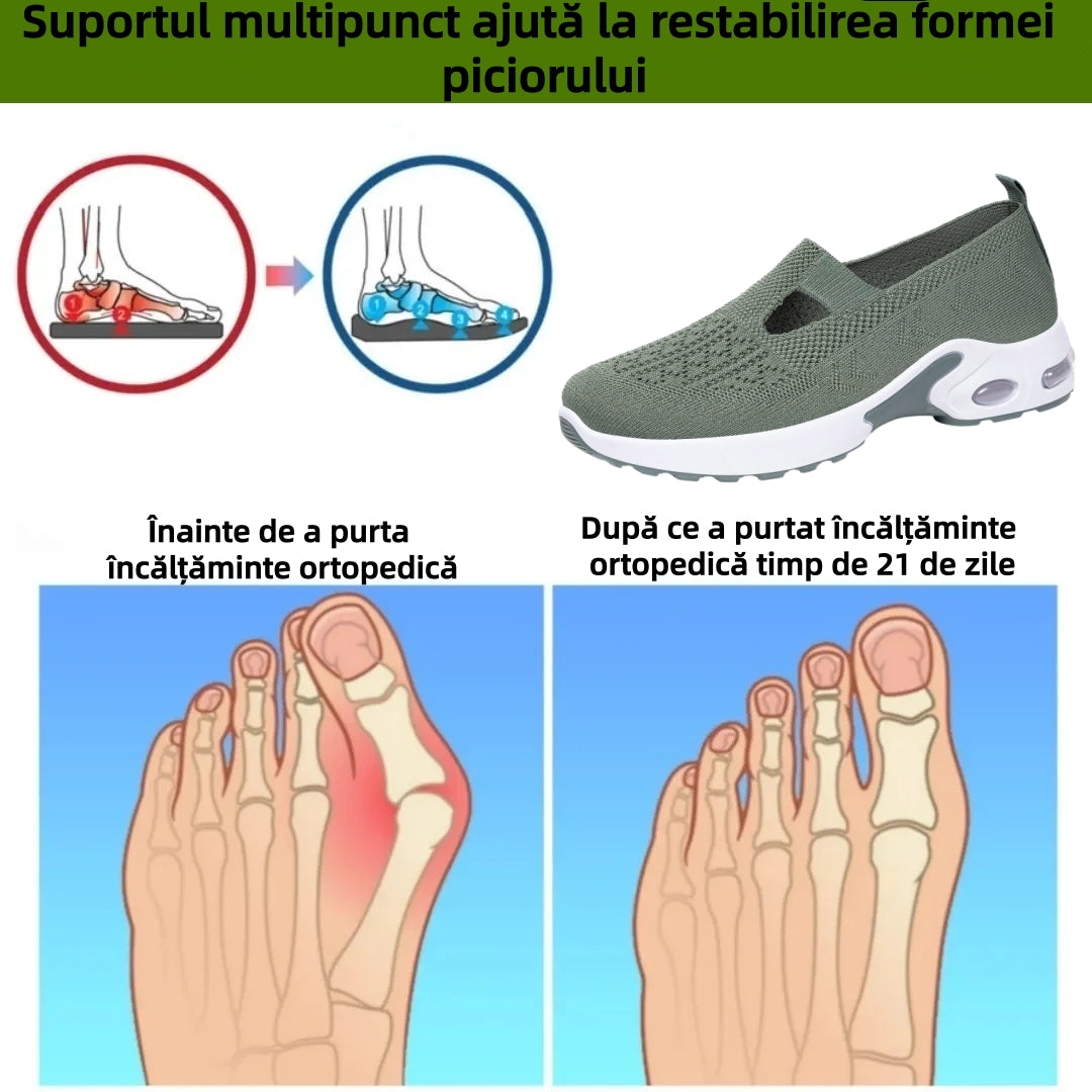 【⏰Oferta specială de astăzi: 70% reducere - Nu ratați!】 Pantofi ergonomici de vară - ✅️ Rezolvă cu ușurință problemele de durere la picioare