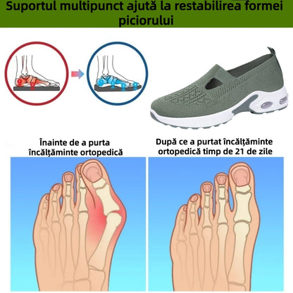【⏰Oferta specială de astăzi: 70% reducere - Nu ratați!】 Pantofi ergonomici de vară - ✅️ Rezolvă cu ușurință problemele de durere la picioare