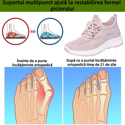⏰Ultima zi! Reducere 70% - Nu rata ocazia! ✅️Încălțăminte de damă confortabilă și respirabilă, cu suport pentru bolta plantară - design ergonomic.